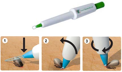 Trix устройство для удаления клеща